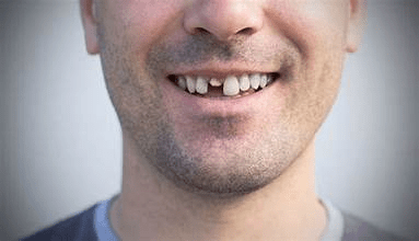 how to battle the nuisance of sensitive teeth
