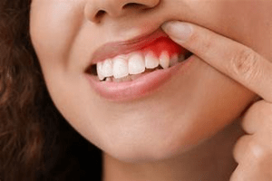 how to battle the nuisance of sensitive teeth